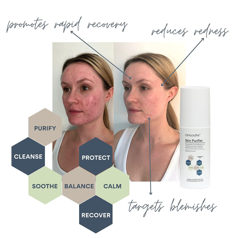 [Australia] - Clinisoothe+ Skin Purifier Spray 100 ml (Pack of 1),Clear - with hypochlorous technology to protect the skin from pollutants and impurities, prevent breakouts and promote rapid recovery. 100 ml (Pack of 1) 