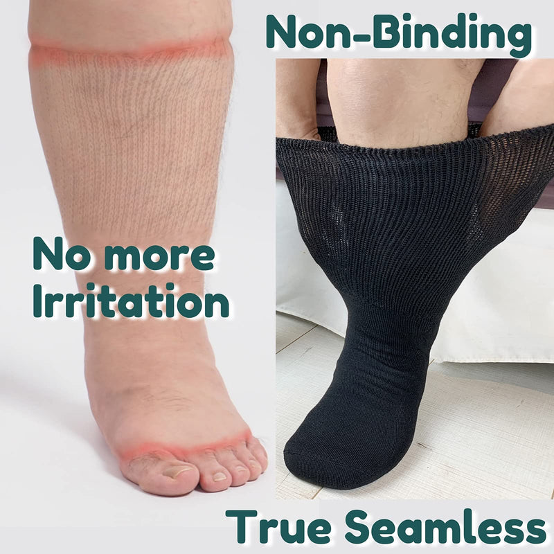 [Australia] - Extra Wide Neuropathy Pain Relief Socks for Swollen Feet Soft Stretches up to 30" Diabetics for Men Women 10-13 13-15 Warm Breathable Non Binding Loose Top Bariatric Edema Cast Over The Calf Plus Size Knee High Socks Extra-Wide Gooi 