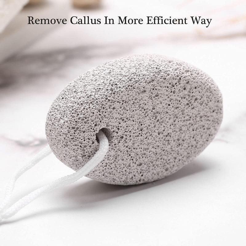 [Australia] - 2PCS Natural Pumice Stone for Feet, HOOMBOOM Lava Pedicure Tools Hard Skin Callus Remover for Men/Women Feet and Hands - Natural Foot File Exfoliation to Remove Dead Skin A&white 