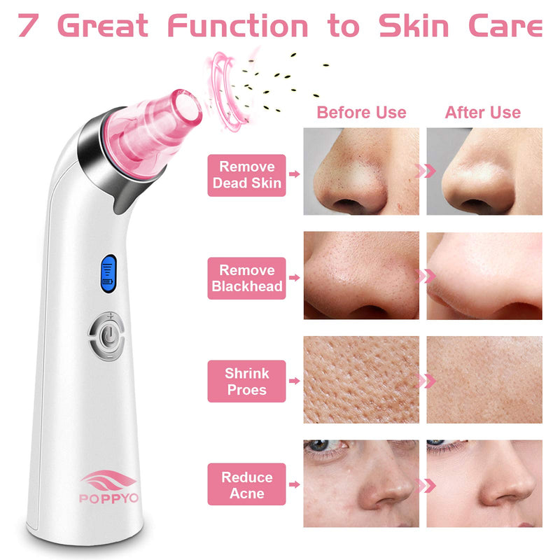 [Australia] - Blackhead Remover Vacuum, POPPYO Blackhead Pore Vacuum, Electric Facial Blackhead & Blemish Removers Cleaner, Blackhead Vacuum for Women（Pink) Pink 