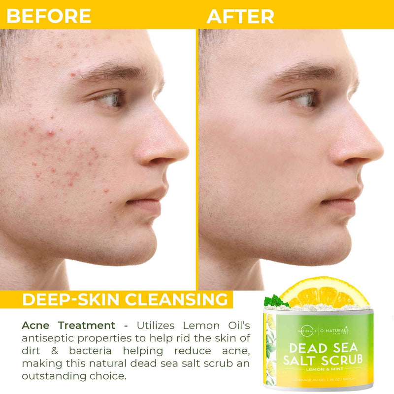 [Australia] - Dead Sea Salt Natural Organic Exfoliating Lemon & Mint Essential Oil Face Body & Foot Scrub. Cleansing, Hydrating, Firming, Dead Skin Ingrown Hairs, Anti Cellulite, Acne, Calluses Men & Women 500gr 
