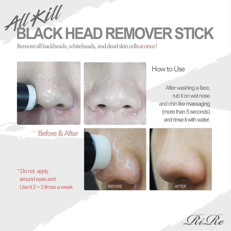 [Australia] - RiRe All Kill Blackhead Remover Stick, 10g / 0.35 oz | Remove Blackhead, Whitehead, Dead Skin Cell, Pore Care 
