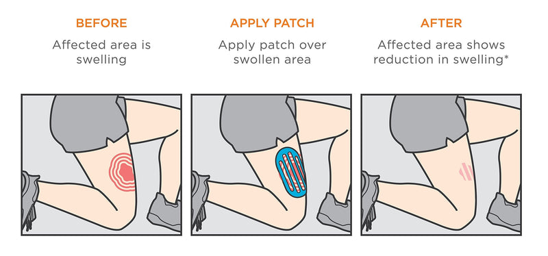 [Australia] - KT Tape Recovery Patch - Tape for Swelling Relief 