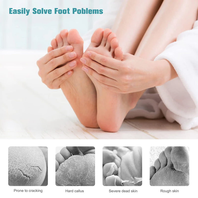 [Australia] - FVION Foot File Dead Hard Skin Remover – Pedicure Rasp Cracked Heels, Double Side Professional Callus Removal for Feet, Stainless Steel Foot Scraper for Feet Care 