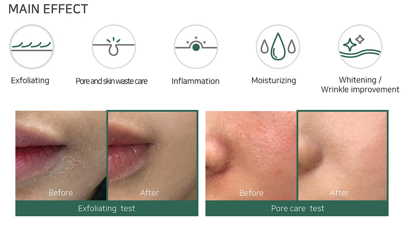 [Australia] - SOME BY MI AHA-BHA-PHA 30 DAYS MIRACLE TONER 150ml - Functional cosmetic toner, (Pack of 1) 