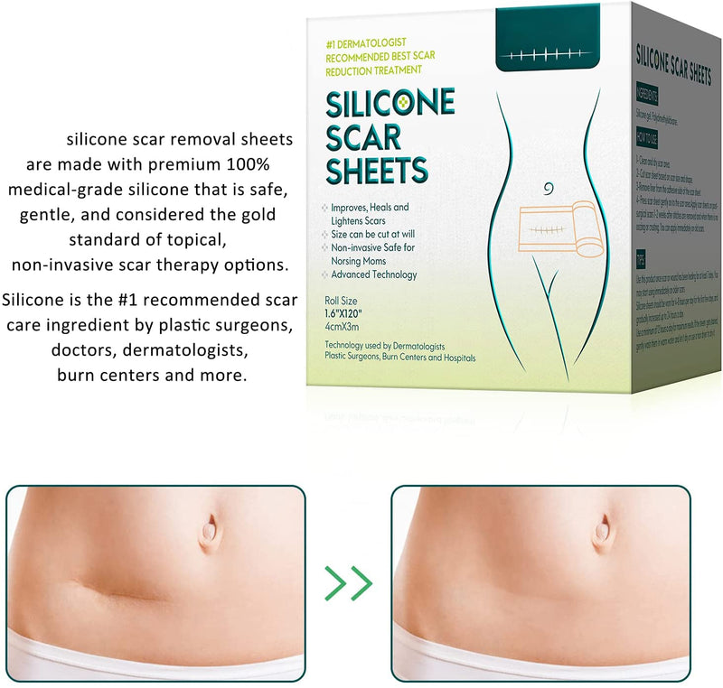 [Australia] - Silicone Scar Sheets (4x300CM), Professional Removal New & Old Scars from Post Surgery,Injury,Burns, Acne Scar Treatment, C-Section, Keloid 