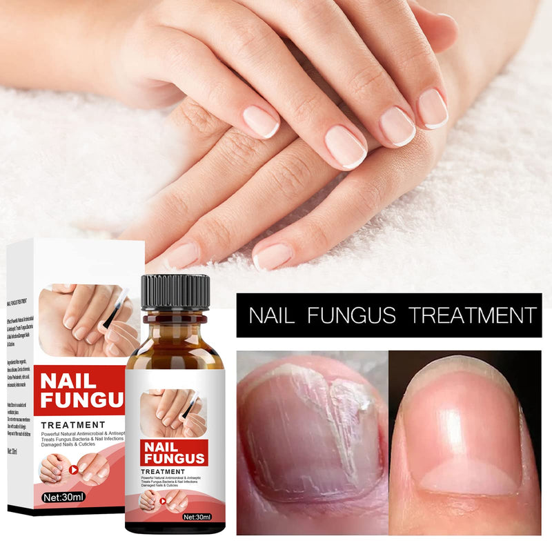 [Australia] - Nail Care Solution,Anti fungal Nail Solution,Nail Fungus Solution,Fungal nail,Nail Fungus Fungus Stop,Restores Appearance of Discolored 