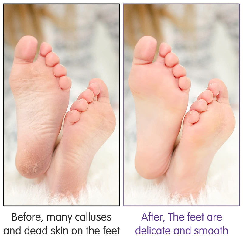 [Australia] - Bubuyun 10PCS Foot Pumice Stone for Feet Callus Remover Stone Pumice Stone for Hard Skin Double Sided Pumice Stone for Feet and Body(12 × 5 × 2.5cm, Purple) 