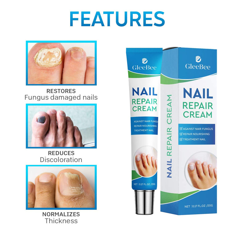 [Australia] - Fungal Nail Treatment, Fungus Nail Cream, Strong Anti-Fungal Toenail Cream, Nail Repair Nourishing Treatment, Restores Discolored and Damaged Nails 