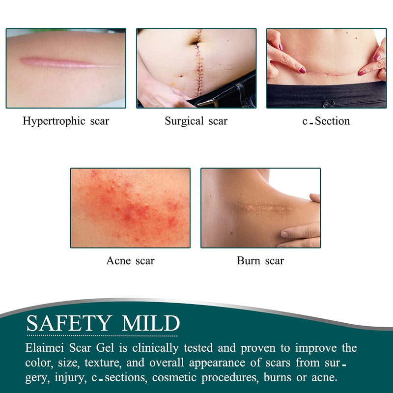 [Australia] - Silicone Scar Sheets (4x300CM), Professional Removal New & Old Scars from Post Surgery,Injury,Burns, Acne Scar Treatment, C-Section, Keloid 