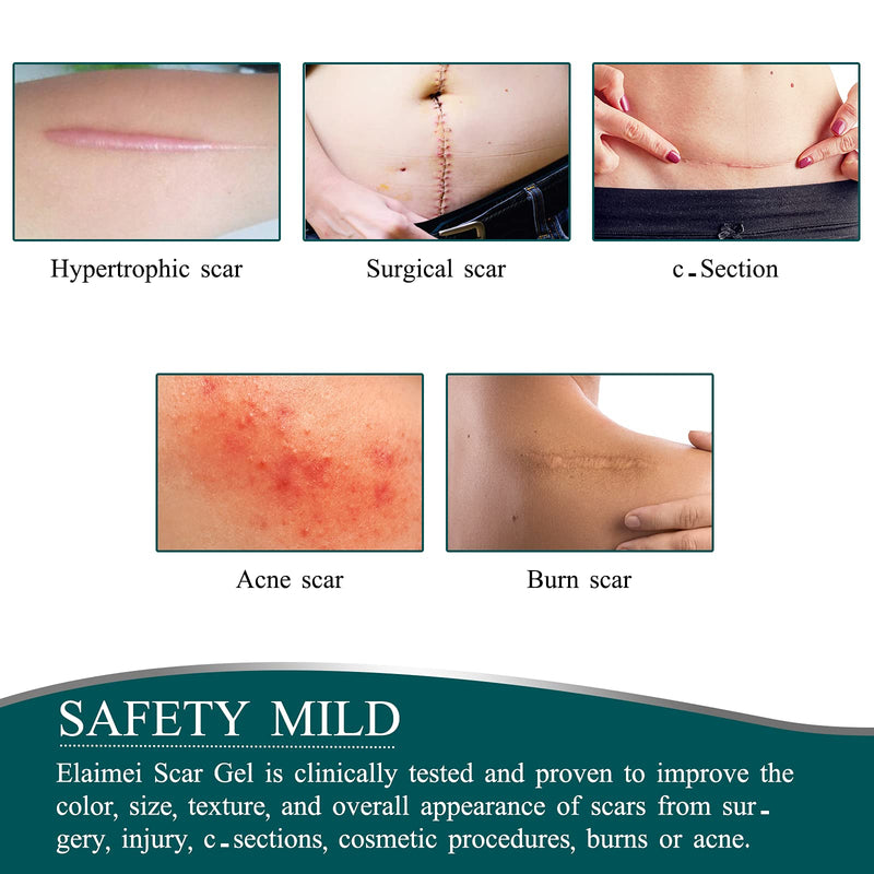 [Australia] - Silicone Scar Sheets, Professional for Scars Caused by C-Section, Surgery, Burn, Keloid, Acne, and More, Drug-Free, Silicone Scar Roll [3Meters] 