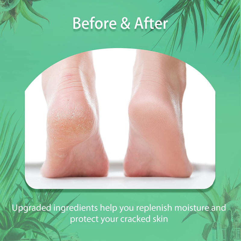 [Australia] - Urea Cream 42% Foot Cream Salicylic Acid 4.3 Oz, Upgraded Callus Remover For Feet, Knees& Elbows, Intensive Moisturizes & Softens Skin, Exfoliates Dead Skin By Vebuni 