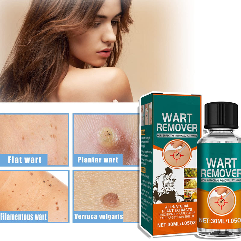 [Australia] - Skin-Tag-Removal,Fast-Acting Skin Wart Removal,Skin Tag Remover Liquid,Safe and Fast-Acting Skin Tag Remover,Natural Wart Remover for All Skin Types,30ml 