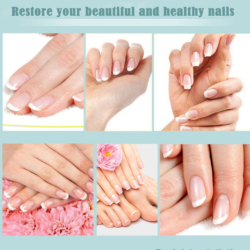 [Australia] - Antifungal Nail Repair,Fungus Treatment Fungal Nail Care,Nail Treatment,Nail Care Solution to Repair Damaged,Cracked and Discolored Nails 