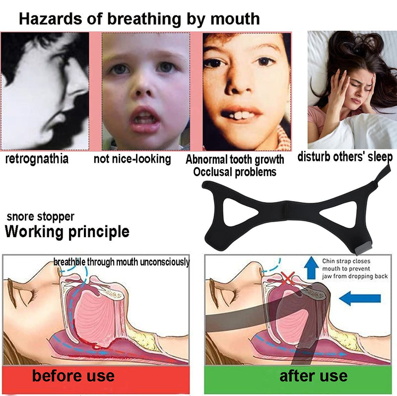 [Australia] - IBLUELOVER Anti Snoring Chin Strap,Stop Snore Chin Strap Snore Stopper,Professional Breathable Anti Snore Devices Adjustable Snoring Solution Belt Stop Snoring Aid for Men Women CPAP Users Black 