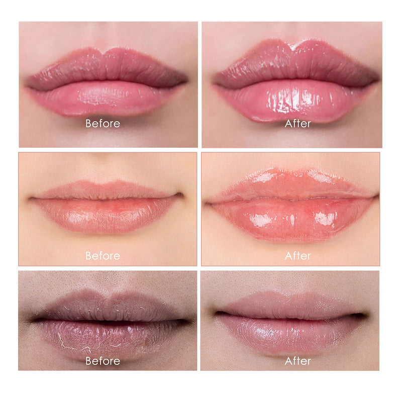 [Australia] - Lip Plumper Set, Natural Lip Plumper, lip plumping lip gloss, lip plumper gloss, Day & Night Care, Lip Enhancer Make Lips Fuller and Moisturizing Beautiful Fuller, Increased Elasticity Lip 