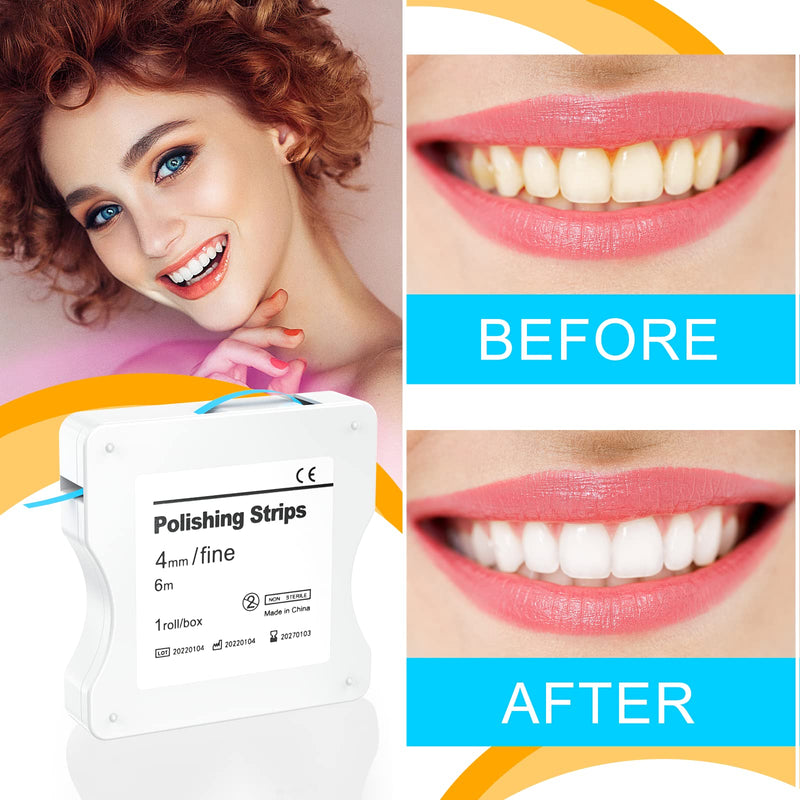[Australia] - AISEELY Dental Polishing Strips, 1Pc Whitening Strip, 4mm Tooth Sandpaper Thickness Teeth Resin Tooth Interdental Grinding Tool, 6m/Rolls/Box (Blue-Fine) Blue 