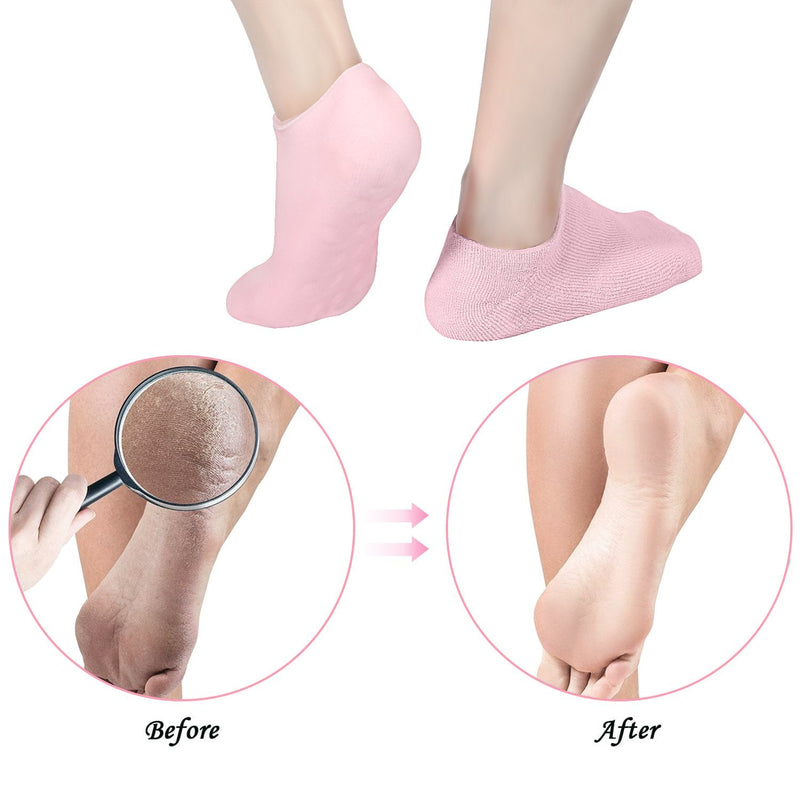 [Australia] - Soft Cotton Gel Moisturizing Spa Gloves and Socks for Cracked Dry Skin for Both Women and Men (Pink) 