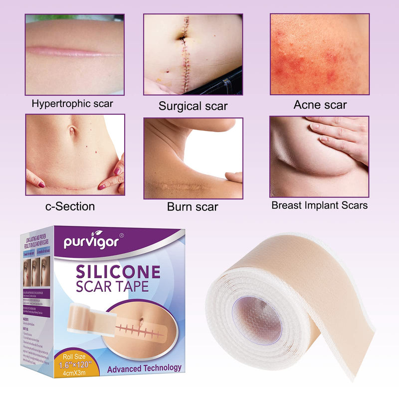 [Australia] - Silicone Scar Sheets(1.6" x 120"), Scar Tape for Scars Removal Treatment, Reusable Professional Scar Removal Strips for New and Old Scars 