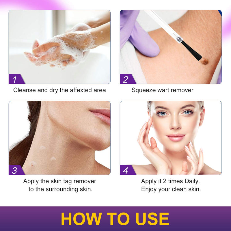 [Australia] - Wart Remover, Skin Tag Remover for Common Warts Treatment, Callus Painlessly, Effective and Safe, Suitable for Face and Body 