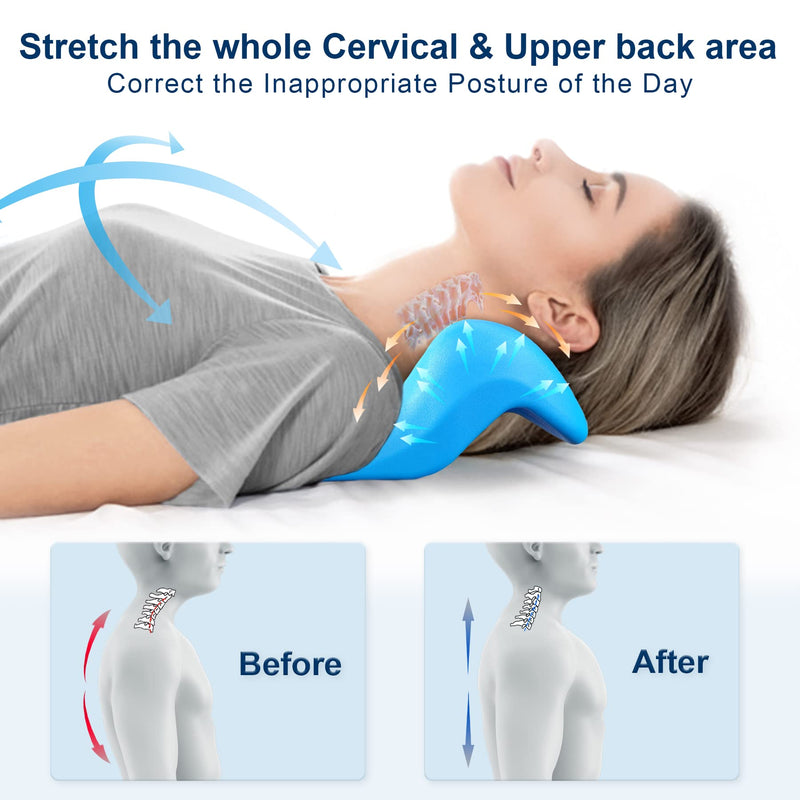 [Australia] - Neck and Shoulder Relaxer with Upper Back Massage Point, Cervical Traction Device Neck Stretcher for TMJ Pain Relief and Cervical Spine Alignment Chiropractic Pillow (Blue) Blue 