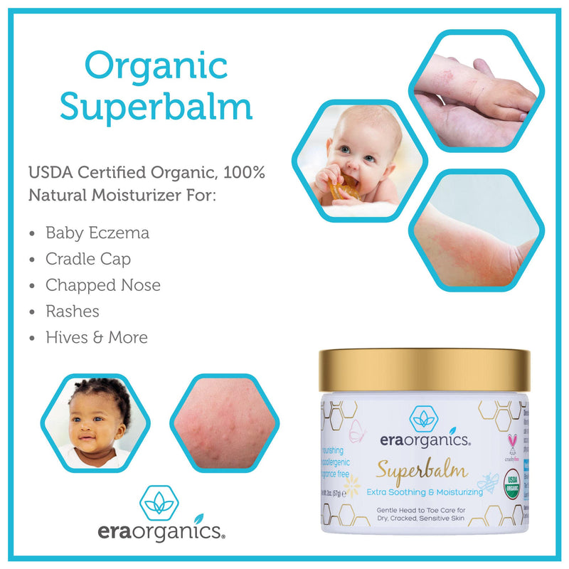 [Australia] - Era Organics Healing Ointment for Babies - USDA Certified Organic Natural Gentle Moisturizer for Sensitive Skin Prone To Baby Eczema, Cradle Cap (Infant Seborrheic Dermatitis), Rashes, Hives & More 