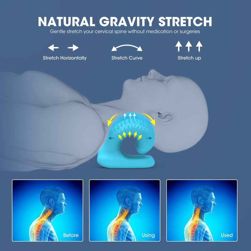 [Australia] - ZAMAT Neck and Shoulder Relaxer with Magnetic Therapy Pillowcase, Neck Stretcher Chiropractic Pillows for Pain Relief, Cervical Traction Device for Relieve TMJ Headache Muscle Tension Spine Alignment Grey 