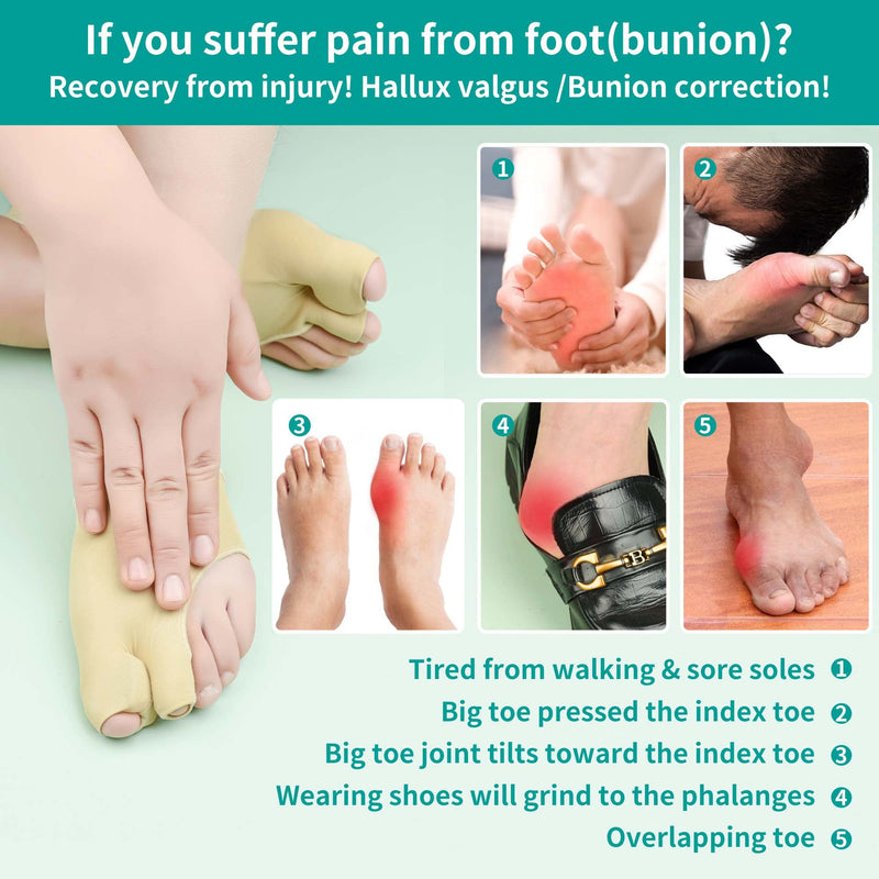 [Australia] - Bunion Corrector Sleeve with Soft Gel Bunion Pads Toe Straightener DYKOOK Toe Separator for Overlapping Toe, Hallux Valgus, Bunion Splint Support Sock Bunion Pain Relief Guard (Large) Beige L 