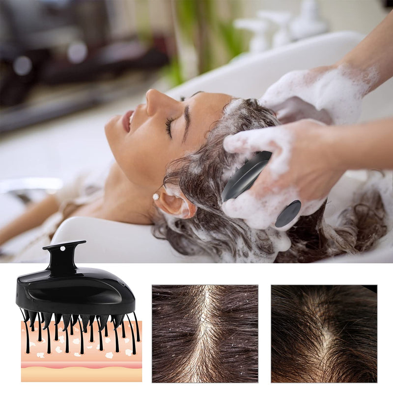 [Australia] - Scalp Massager Shampoo Brush, Soft Silicone No Flaky Scalp Brush for Wet or Dry Hair, Head Scrubber Scalp Exfoliator Anti Dandruff Brush(All Back) All Back 