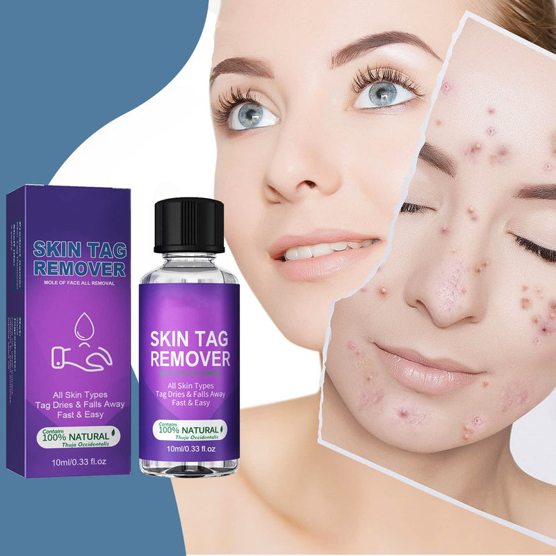 [Australia] - Natural Ingredients Skin Tag Removal,Skin Tag Removal & Natural Repair Gel,Wart & Mole Remover,Repair Lotion Set,Easy to Use at Home 