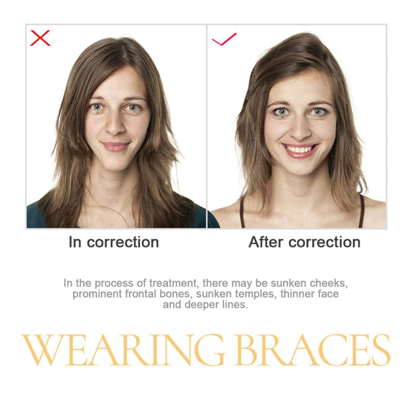 [Australia] - 2 Pcs Aligner Chewies for Invisalign Trays, Aligner Tray Seaters, Teeth Chewies, Jaw Exerciser, Use for Oral Care Dental Mouth Health 