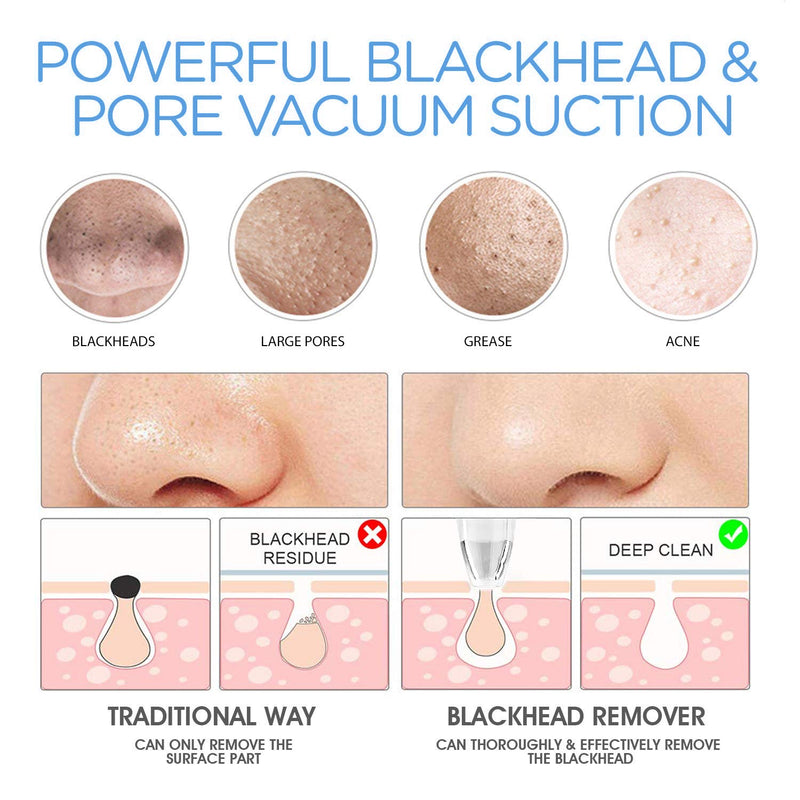 [Australia] - Blackhead Remover Vacuum Electric Blackhead Removal Tools Pore Cleaner with LED Display Deep Cleaner Blackhead Including 4 Patterns and 5 Suction Probes USB Rechargeable for Dry, Normal, Oily Skin 