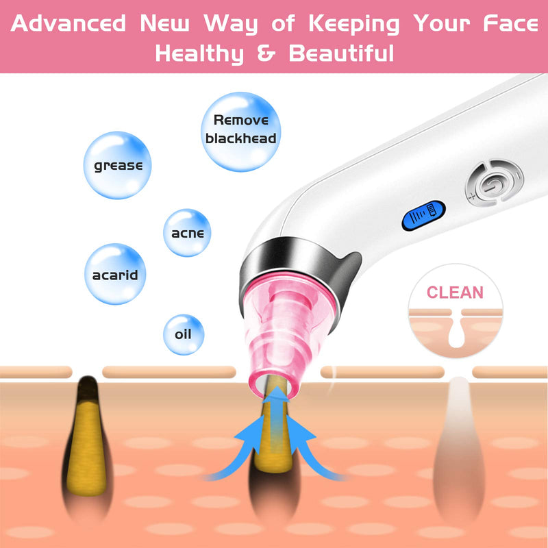 [Australia] - Blackhead Remover Vacuum, POPPYO Blackhead Pore Vacuum, Electric Facial Blackhead & Blemish Removers Cleaner, Blackhead Vacuum for Women（Pink) Pink 