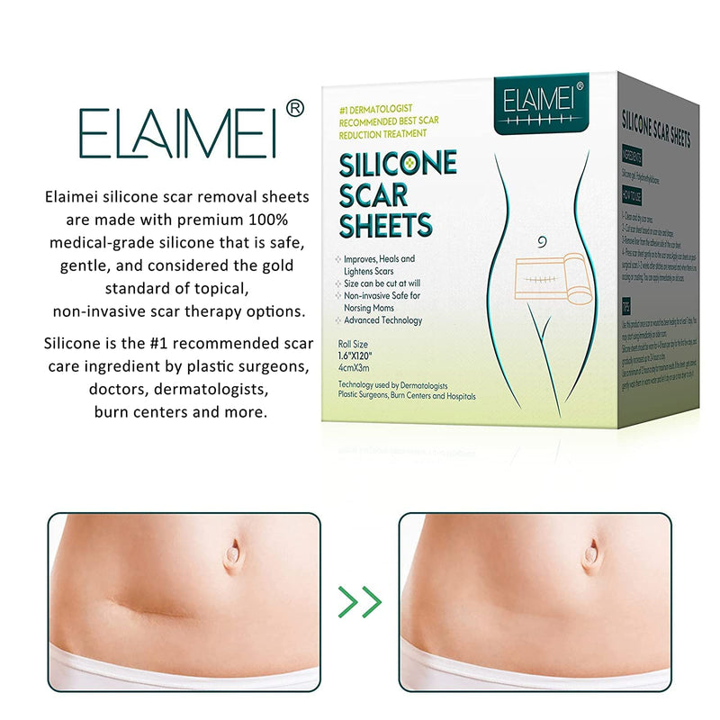 [Australia] - Silicone Scar Sheets (1.6” x 60” - 1.5M), Professional Medical Grade Silicone Scar Removal Sheets for Surgery, Csection,Keloid, Burn, Safe and Painless Silicone Scar Tape (Pack of 1) (1.5M) 