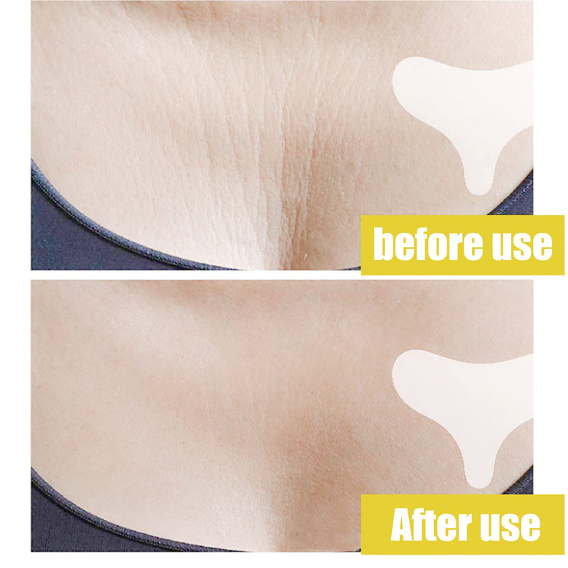 [Australia] - Chest Wrinkle Pad 1Pcs Anti Wrinkle Chest Pads, Silicone Chest Pad Anti-Aging Reusable Chest Pad Tightening Overnight Medical Grade Anti Wrinkle Patches for Preventing Wrinkles and Smoothing Skin 