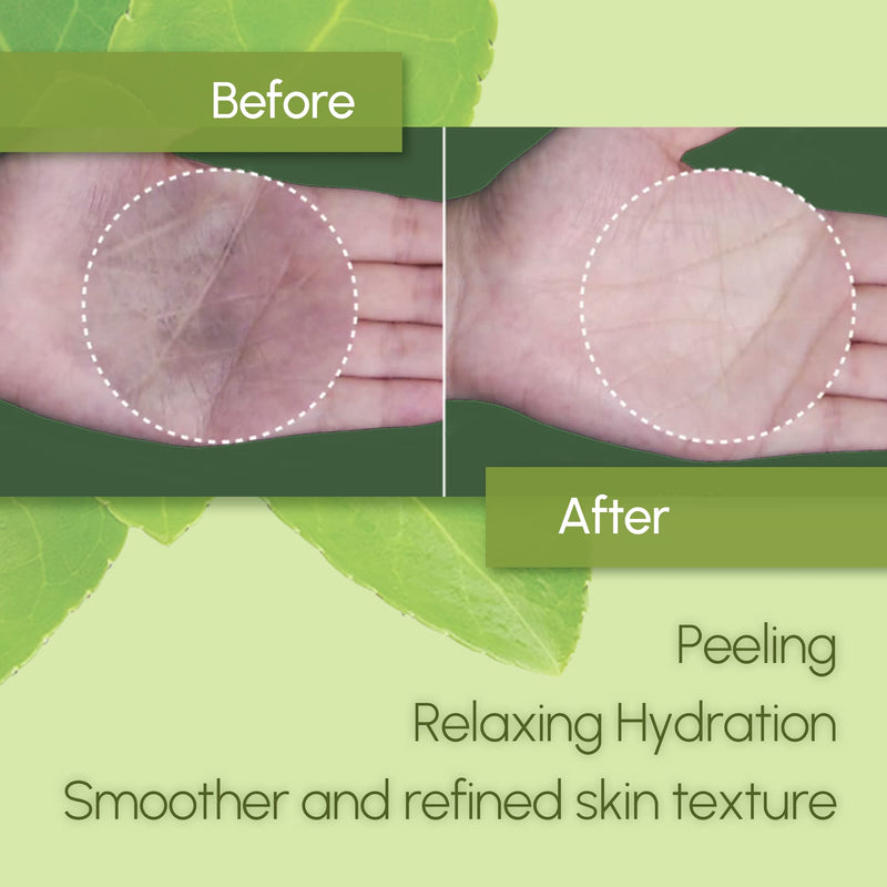 [Australia] - Neogen Dermalogy Bio Peel Gauze Peeling Green Tea (200Ml/30Pads) Premium Exfoliating Pads 