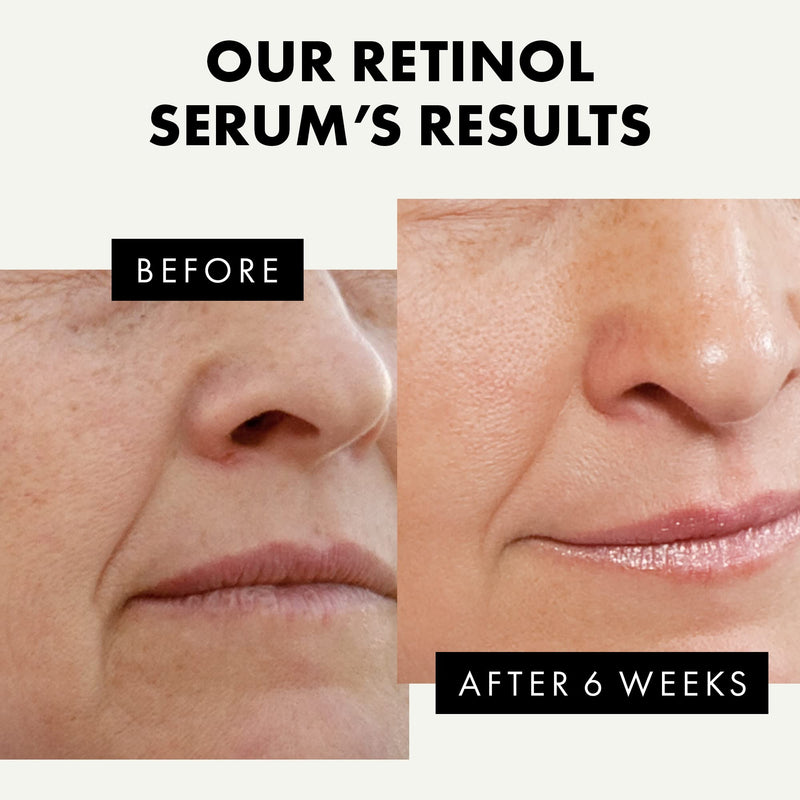 [Australia] - Pure Retinol Serum for Face & Neck (2.5%) - Vitamin A Anti-Aging/Wrinkle/Acne Skin Resurfacing Retinol Serum - Pro Moisturizing & Brightening Prescription Strength Retinoid Treatment for Women & Men 