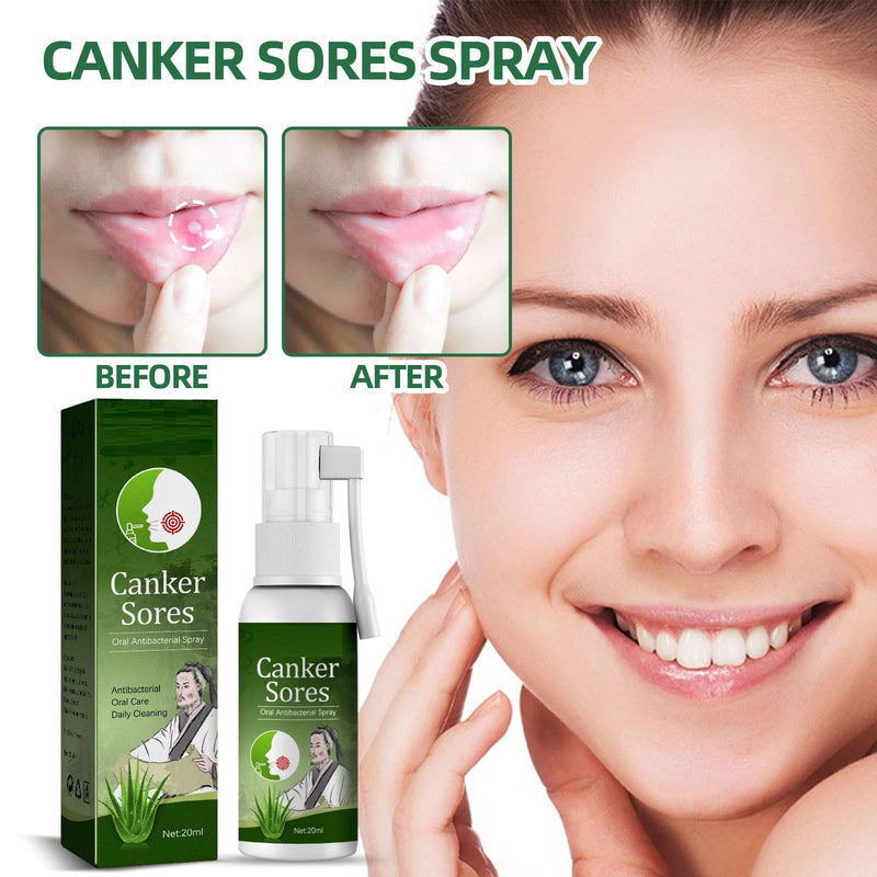 [Australia] - Mouth Ulcer Spray,Mouth Ulcer Treatment Spray,Mouth Ulcer Spray for Adults,Mouth Ulcer Treatment for Adults,Breath Spray for Bad Breath,Herbal Mouth Spray,Herbal Clean Mouth Spray,20ml 20ML 1pc 