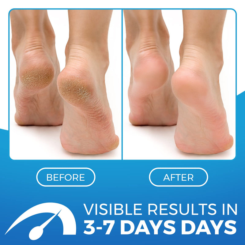 [Australia] - 2 in 1 Cracked Heel Repair Cream | XL Moisturiser for Dry Skin Foot Cream | Dry Skin Cream Foot Cream by IMPERIAL FEET 