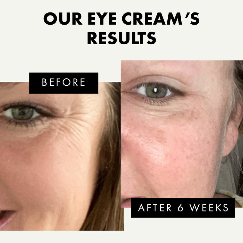 [Australia] - ORGANIC Eye Cream - 3X MORE POTENT ENCAPSULATED VITAMIN E Anti-Ageing with Soothing Oat Extract, HA and Antioxidants - GMP-Certified/DERMATOLOGIST APPROVED 