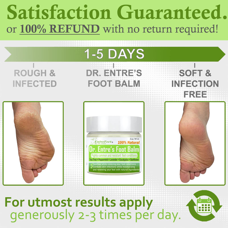 [Australia] - Dr. Entre's Antifungal Foot Balm: Tea Tree Oil & Shea Butter Based - Organic Treatment Cream for Athletes Foot, Dry Feet, Cracked Heels, Itching, and Odor - Foot Care E-Book Included 