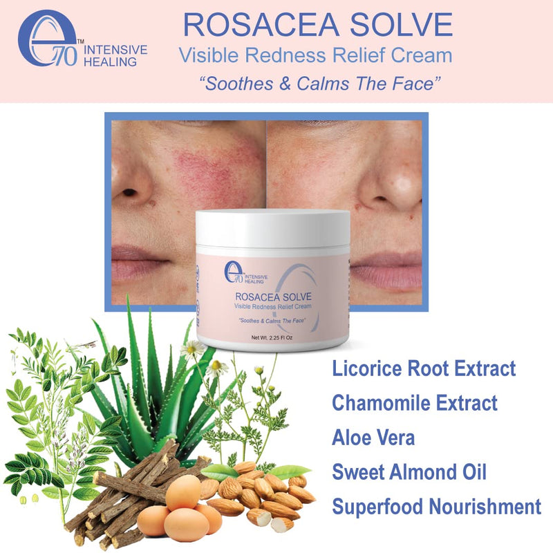 [Australia] - E70 Rosacea Solve - Redness Relief Cream - Calming Face Moisturizer For Rosacea and Acne-Prone Skin - Sensitive Skin Care With Organic Ingredients such as Aloe Vera, Almond Oil, Licorice and Chamomile Extracts - No Parabens 