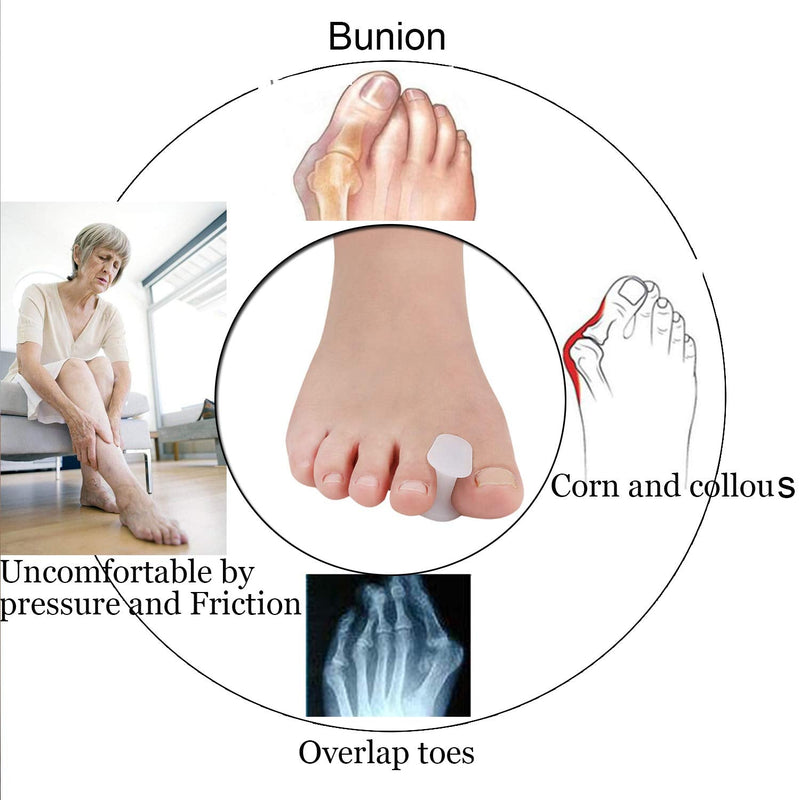 [Australia] - 10 Pieces /5 Pairs Gel Toe Spacers, Toe Separators Bunion Corrector Gel Orthotics for Bunion, Overlapping Toes - L Size(Updated Soft Version) 