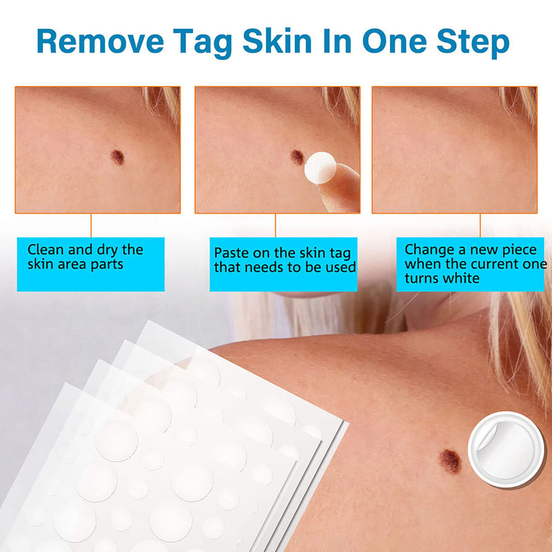 [Australia] - Memonotry Skin Tag Remover Patches, Premium Formula Wart Remover, Safe and Effective Skin Tag Removal, Suitable for Face & Body, White/, 144 Count (Pack of 1) 