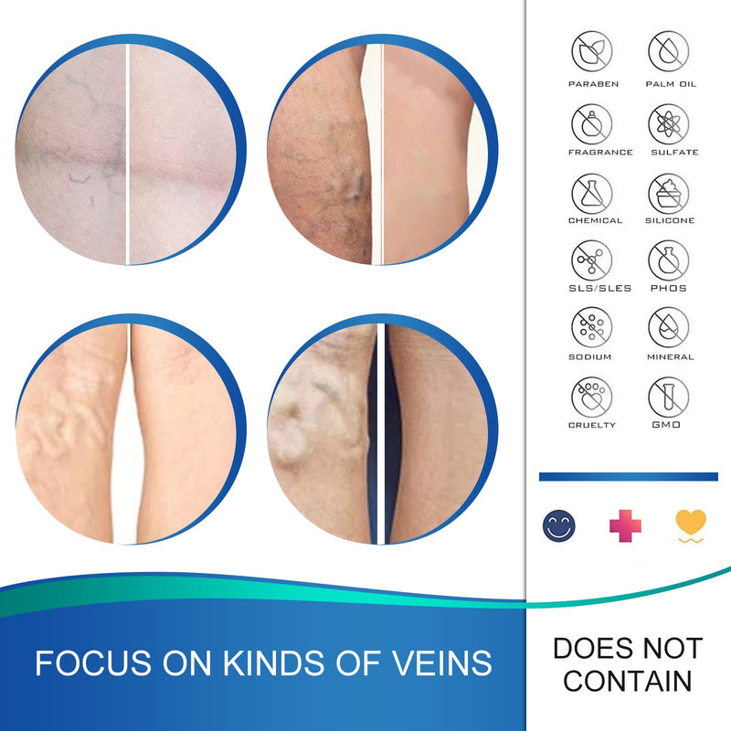 [Australia] - Memonotry Varicose Veins Treatment for Legs, Varicose Veins Patches, Relief Phlebitis Angiitis Inflammation, Improve Blood Circulation for Strengthen Capillary Health, Brown 12 