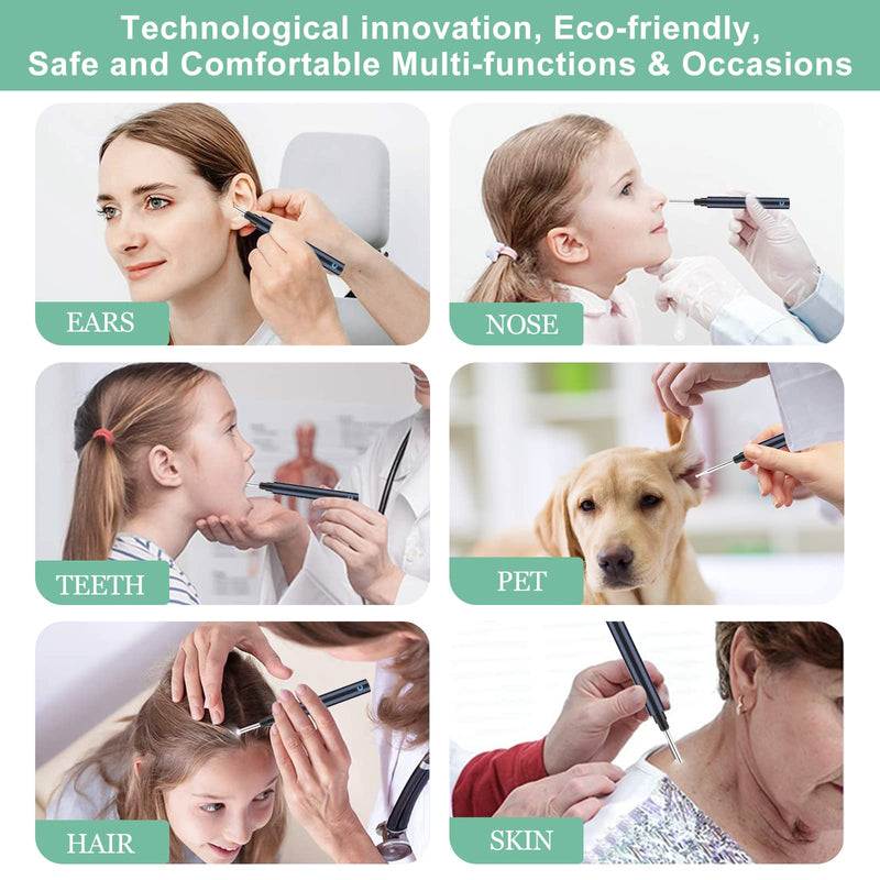 [Australia] - Topicy Ear Wax Removal Tool Camera, Ear Cleaner with Camera Kit Wireless Ear Otoscope 1296P FHD, 6 LED Lights, Ear Cleaning Ear Wax Removal HY01 
