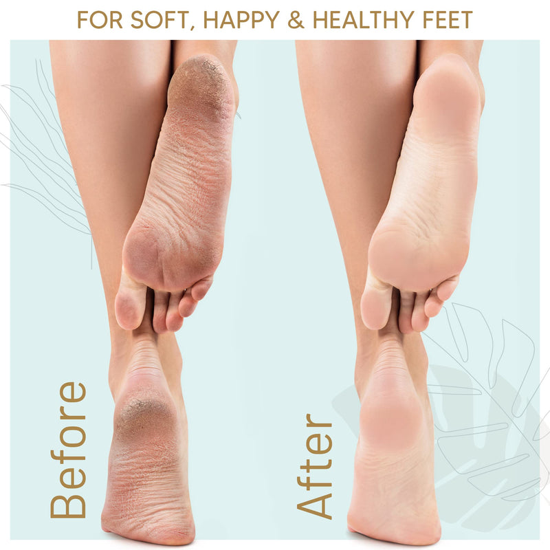 [Australia] - Foot Callus Remover Gel 6oz By Love, Lori - Callus Remover For Feet & Dead Skin Remover For Feet - Works With Foot Scrubber, Pumice Stone For Soft Feet - Professional Pedicure Results At Home 