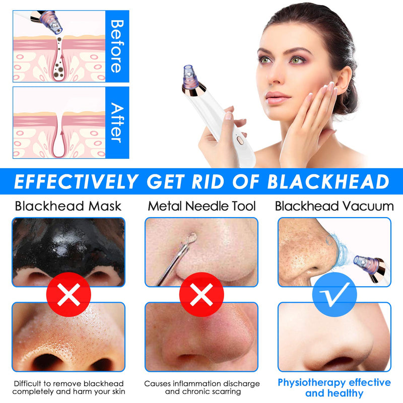 [Australia] - Blackhead Remover Pore Vacuum,5 in 1 Rechargeable Blackhead Vacuum Tools Kit with 3 Adjustable Strength, Electric Comedo Suction Device with 5 Blackhead Extractor White 