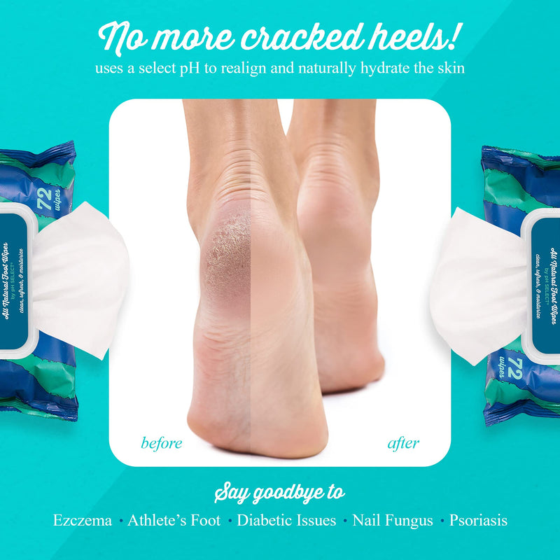 [Australia] - pH Select - pHeet Foot Wipes, Dry Feet Moisturizing Wipes, Foot Cleaner for Dirty Feet, Clean Wipes for Avoiding Foot Odor, Ideal for Cracked Heels and Flaky Skin, 72 Wipes 