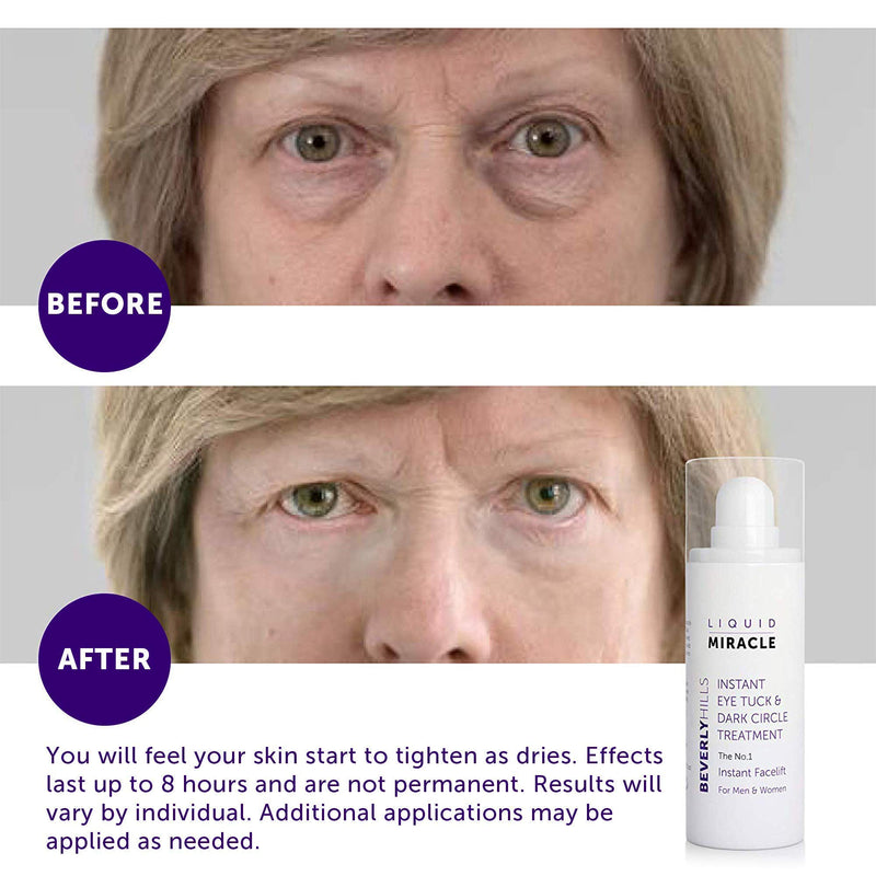 [Australia] - Beverly Hills Instant Facelift and Eye Serum Treatment for Dark Circles, Puffy Eyes, and Wrinkles 